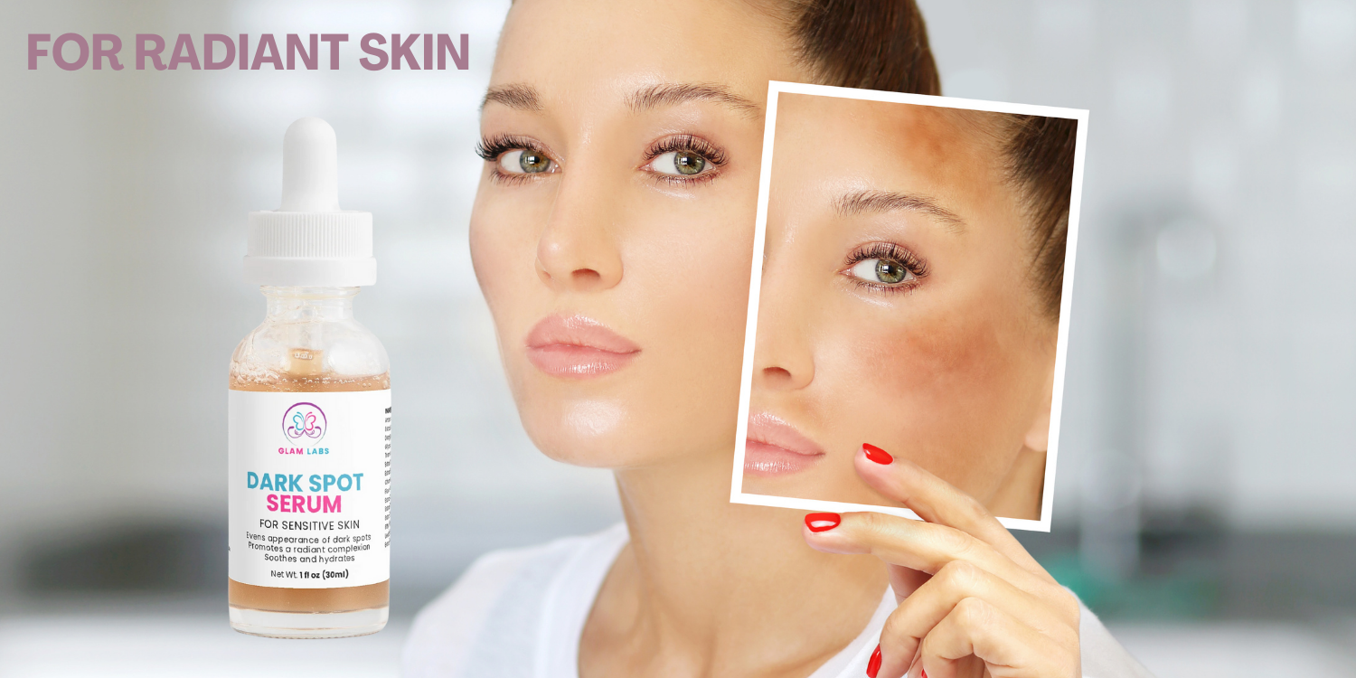 Infographic 1 for Dark Spot Super Serum for Sensitive Skin