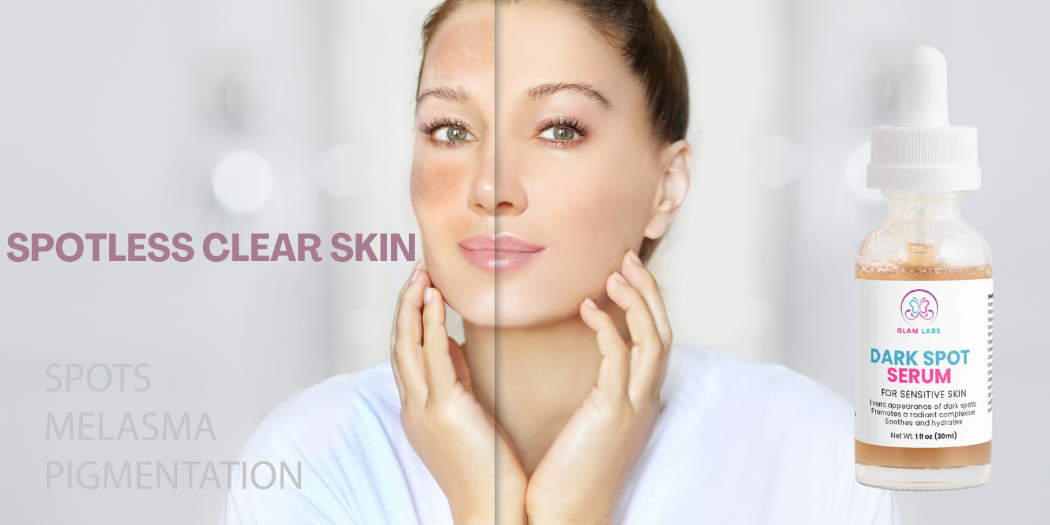 Infographic 3 for Dark Spot Super Serum for Sensitive Skin